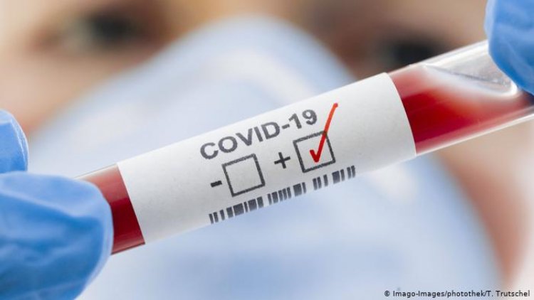 COVID-19’da 24 saatte 22 bin 83 yeni vaka, 69 ölüm