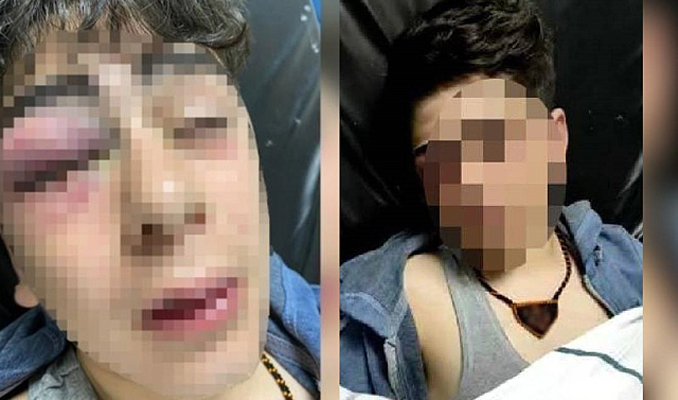 14 yaşındaki çocuğu darp iddiasında 5 polise uzaklaştırma