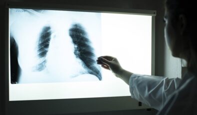 DSÖ: 2022’de 7,5 milyon kişiye tüberküloz tanısı konuldu