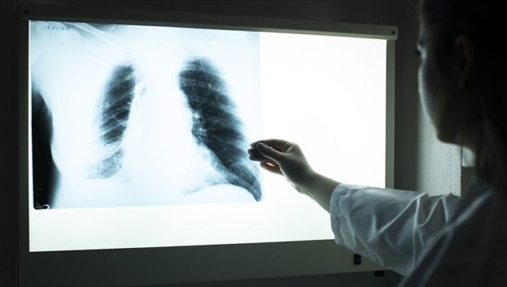 DSÖ: 2022’de 7,5 milyon kişiye tüberküloz tanısı konuldu
