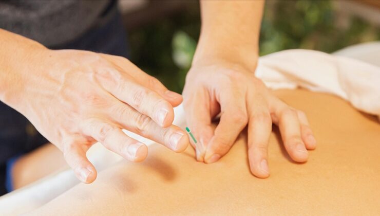 Akupunktur konuşma güçlüğü tedavisinde katkıda bulunuyor