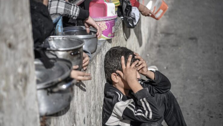 Gazze’deki çocuklar yetersiz beslenme nedeniyle tedaviye ihtiyaç duyuyor